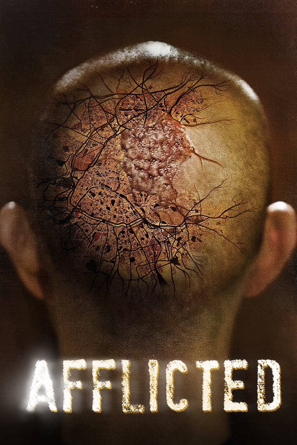 ดูหนังออนไลน์ Afflicted มหาภัยเชื้อเหนือมนุษย์